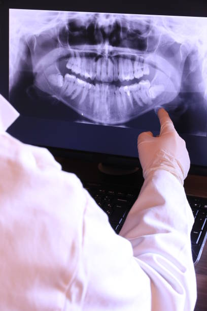 Best Dental Abscess Treatment in Lyndonville, VT